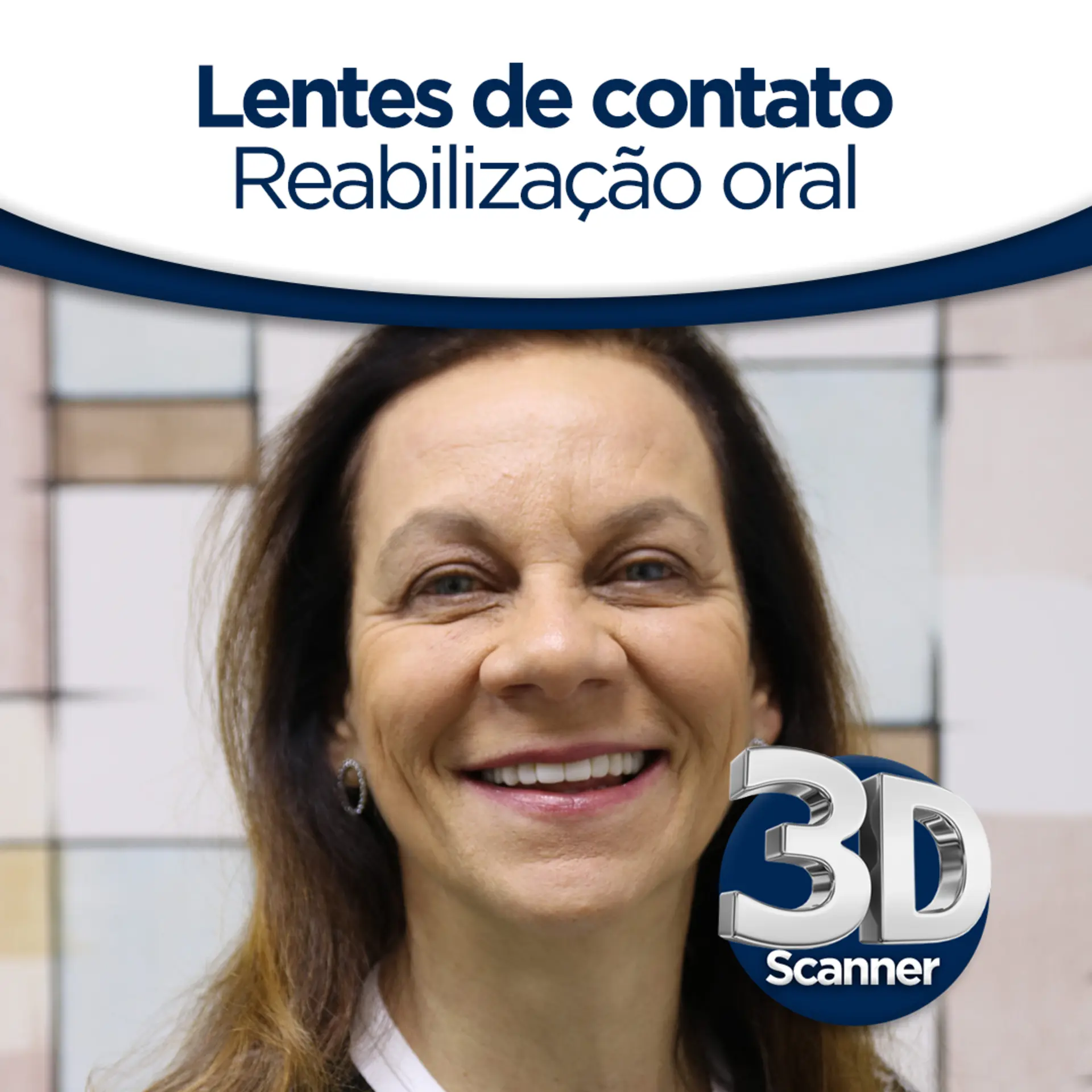 Scanner 3D